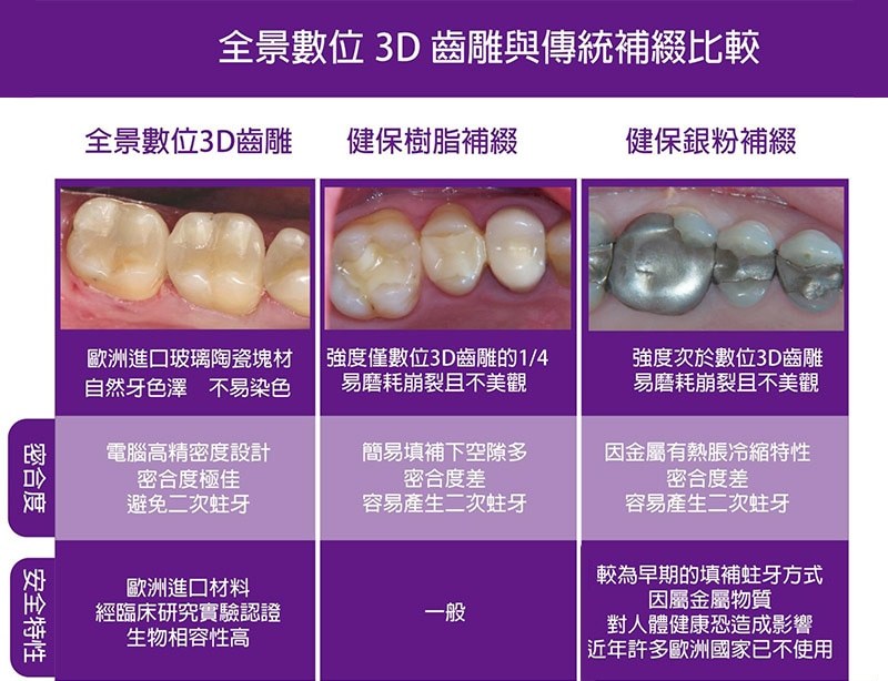 牙周病-治療-數位牙科-陶瓷貼片-全瓷冠-數位牙科與全瓷修復-全瓷修復3D齒雕與傳統補綴的比較