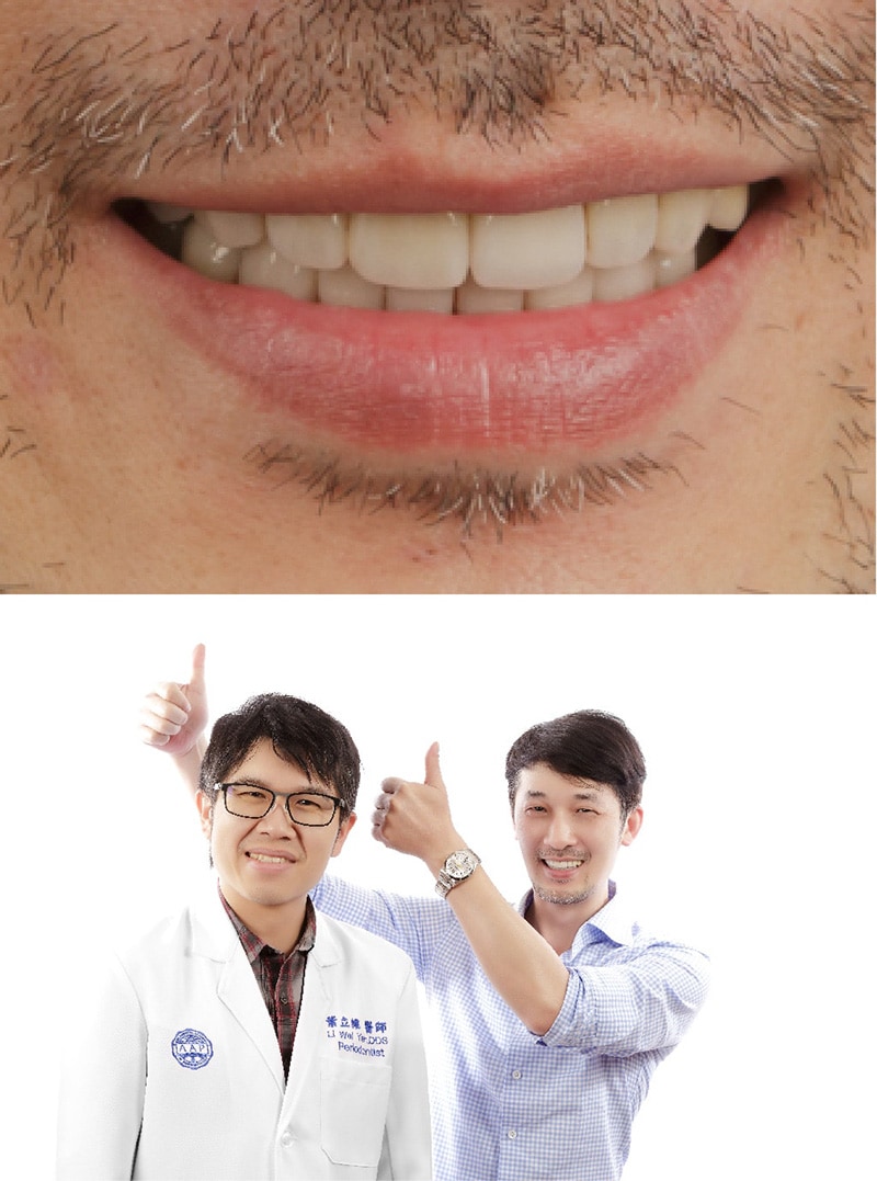 嚴重牙周病治療-無拔牙治療-患者與葉立維醫師的滿意合照-桃園