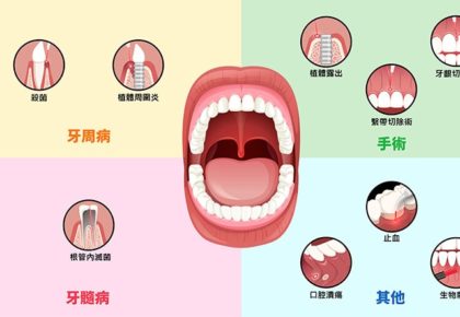 雷射治療牙周病的效果好嗎?「雷射」跟「水雷射」牙周病治療費用及優缺點比較