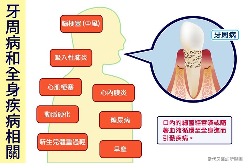 牙周病細菌-牙周病全身疾病示意圖-cnews新聞網報導