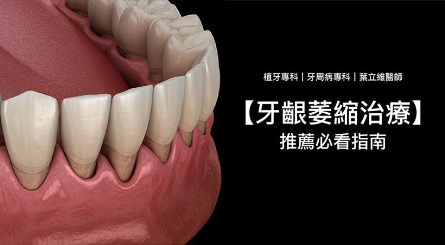 牙齦萎縮如何補救？牙齦萎縮的原因、症狀、治療方法