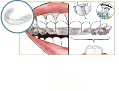 牙周病治療-牙周病治療第一階段-MAPCARE牙周病治療方案-牙周維護-桃園牙周專科-葉立維醫師