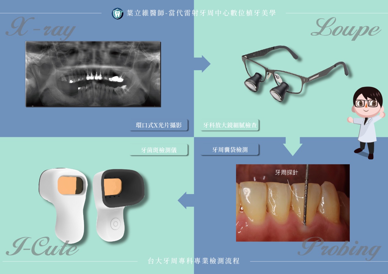 牙周病專科-牙周病專科醫師-牙周病檢查步驟-葉立維醫師-桃園