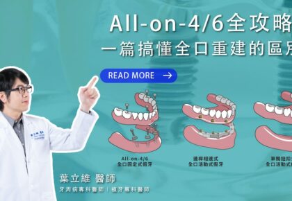 全口重建的選擇方案：全口植牙和全口速定植牙(All-on-4/6/X)有什麼差異？
