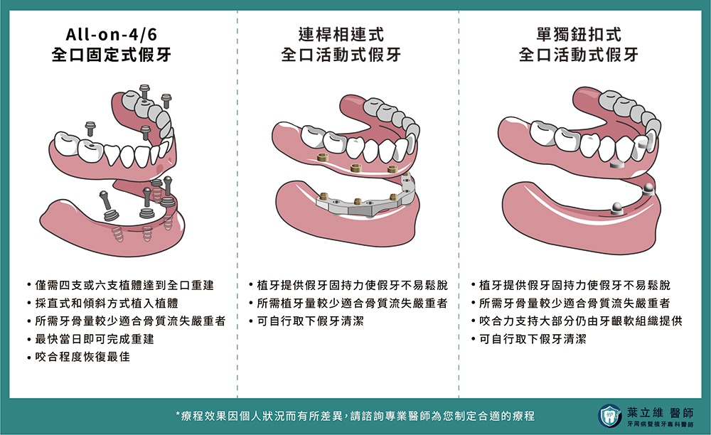 植體輔助固定式、活動式假牙的全口重建方式，包含：All-on-4/6全口固定式假牙、連桿相連式全口活動式假牙、單獨鈕釦式全口活動式假牙