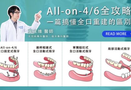 全口重建的選擇方案：全口植牙和全口速定植牙(All-on-4/6/X)有什麼差異？