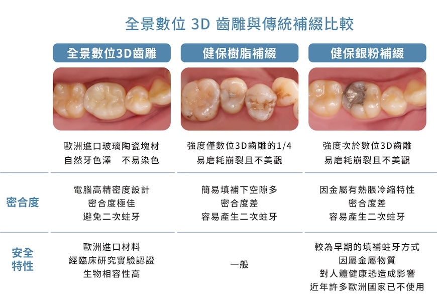 全景數位3D齒雕與健保樹脂補綴、銀粉補綴三種補牙方式的比較圖,說明材質外觀、密合度與安全性差異