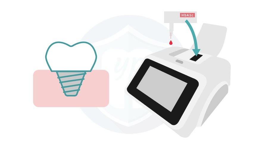 牙科門診糖化血色素快速檢測設備