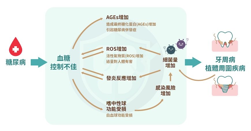 糖尿病影響免疫功能造成牙周病與植體周圍炎示意圖