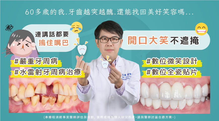 嚴重牙周病非手術治療推薦: 水雷射/全鋯冠牙橋/瓷牙貼片