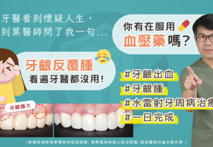 高血壓患者牙周病治療推薦：顯微水雷射牙周治療/DSD數位微笑設計
