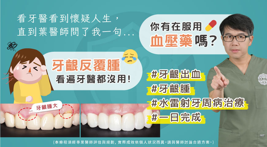 高血壓患者牙周病治療推薦：顯微水雷射牙周治療/DSD數位微笑設計